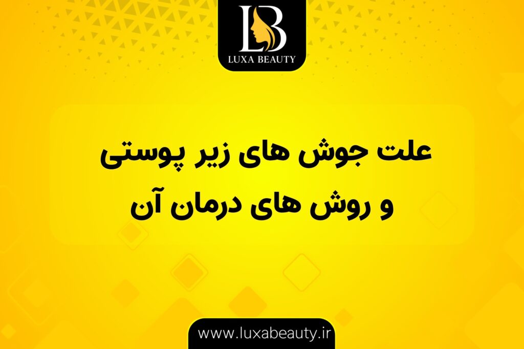 علت جوش های زیرپوستی و روش‌های درمان آن در پوست صورت